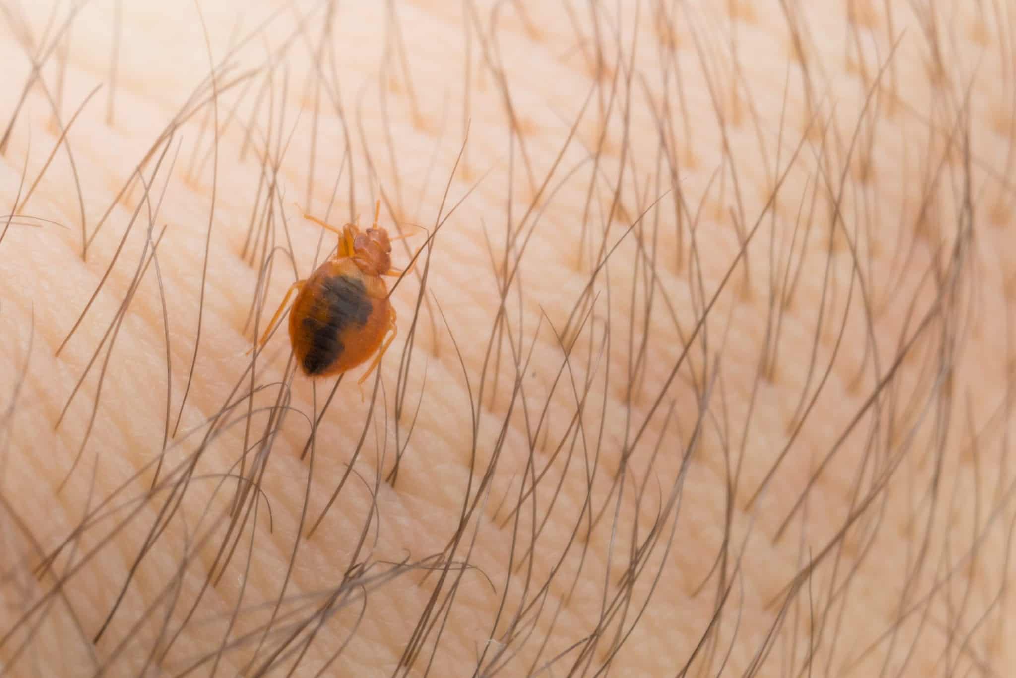 bedbug 5 scaled 4 Ways to Get Rid of Bedbugs