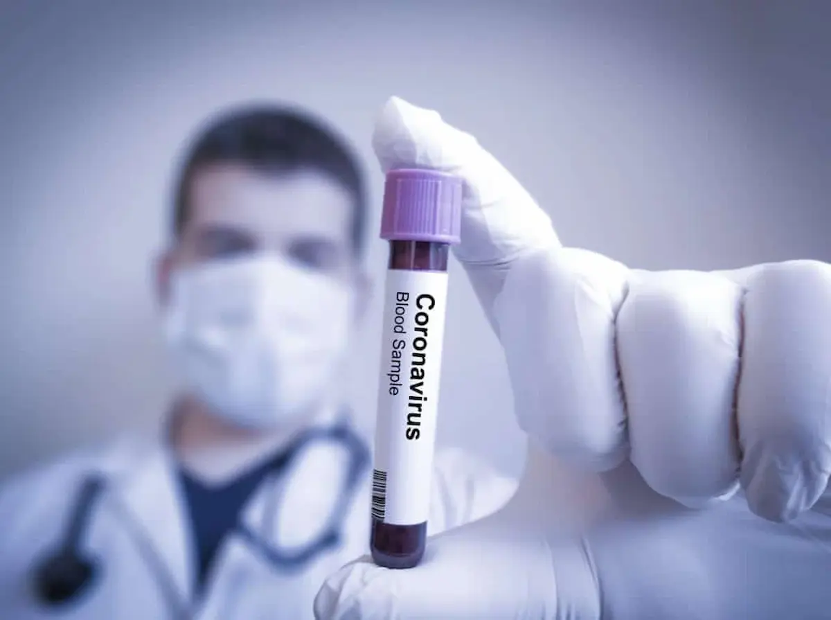 Coronavirus blood sample test tube