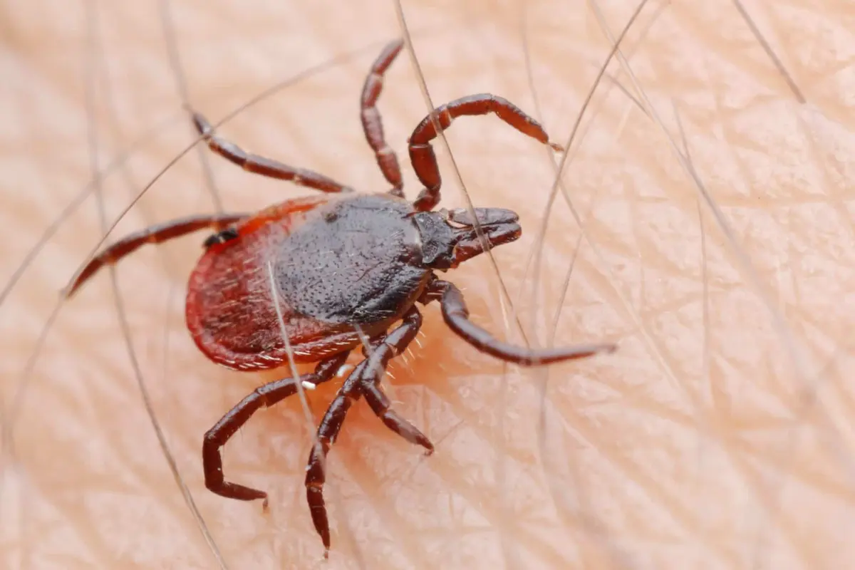 Macro close-up of tick attached to human skin with visible hairs