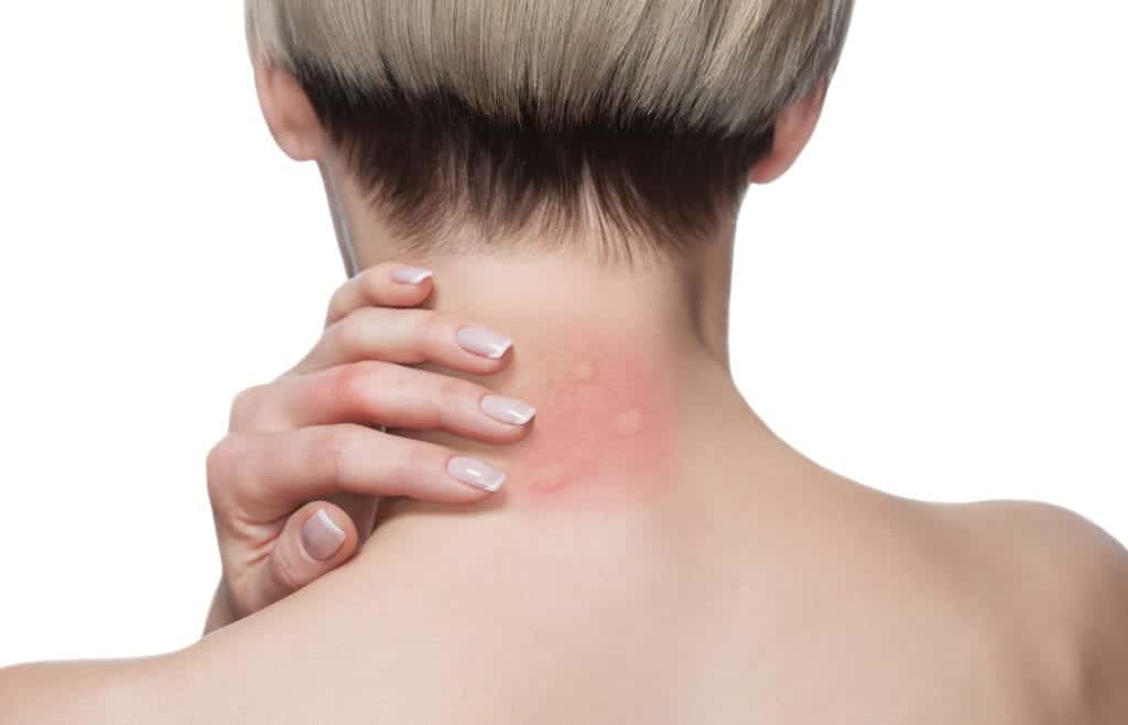 shutterstock 1333126100 10 Facts About Awful Mosquitos