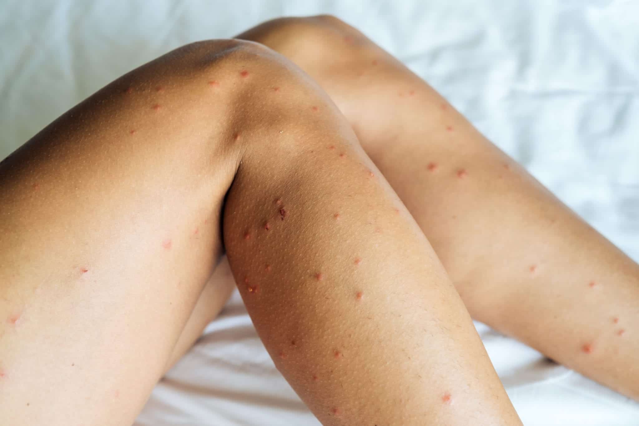 shutterstock 1770315002 scaled Picky Bed Bugs
