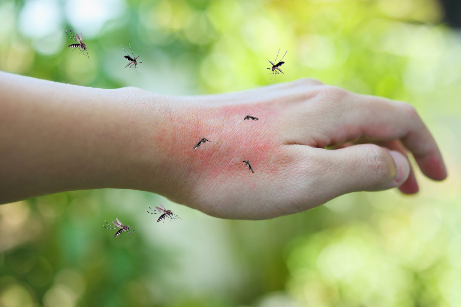 Mosquitoes,Bite,On,Adult,Hand,Made,Skin,Rash,And,Allergy Pointe Pest