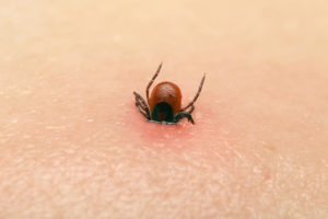 shutterstock 292714097 Encephalitis,Tick