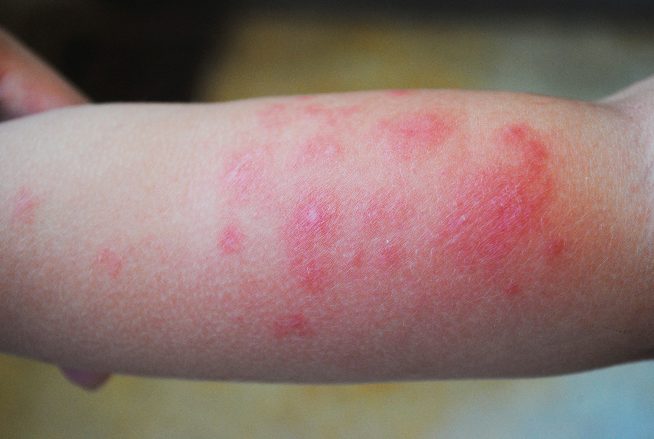 shutterstock 1409573924 scaled What are Midges?