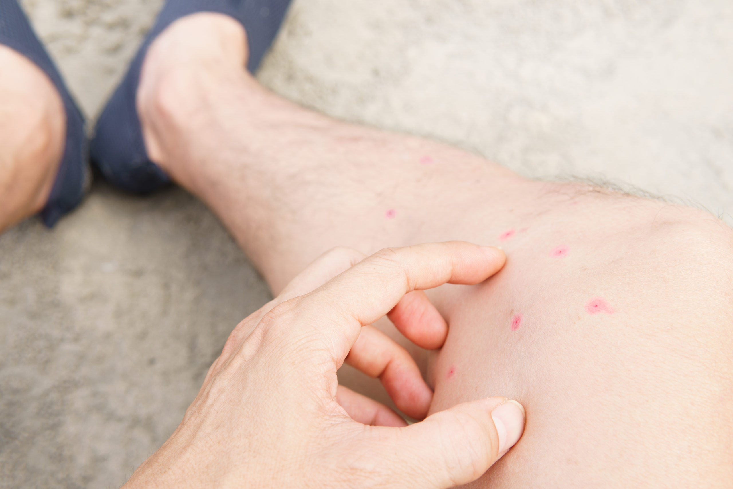 shutterstock 1846994986 scaled Flea Treatments